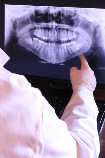 Best Emergency Wisdom Tooth Extraction in Kensett, AR