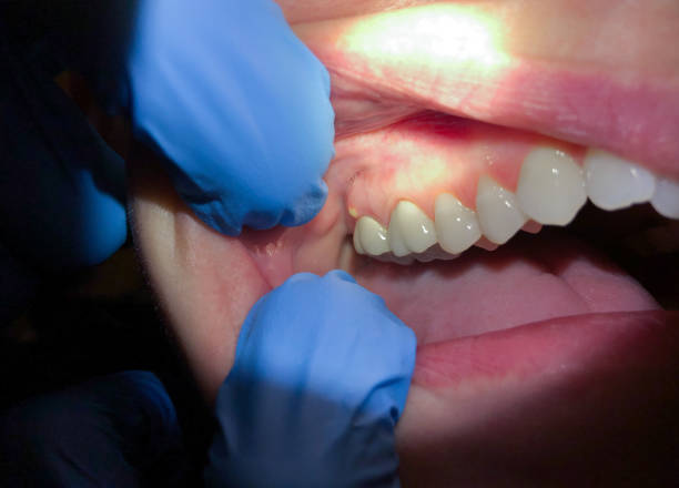 Best Walk-In Emergency Dental Services in Kensett, AR