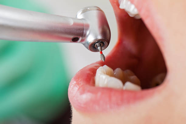 Best Emergency Cosmetic Dentistry (e.g., broken veneers) in Kensett, AR